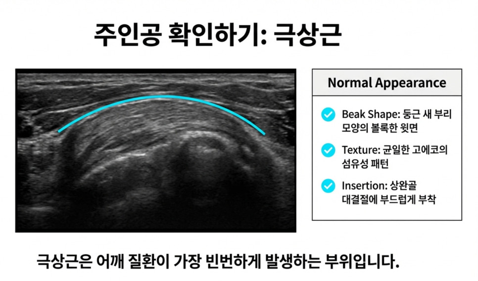 정상 극상근 힘줄의 초음파 소견