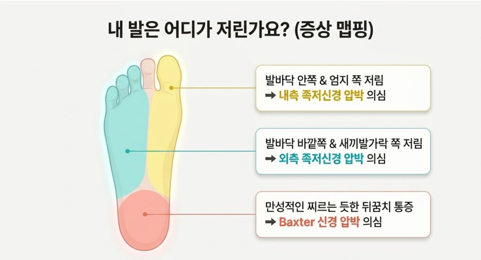 발바닥 저림 부위별 의심 신경 증상 도식